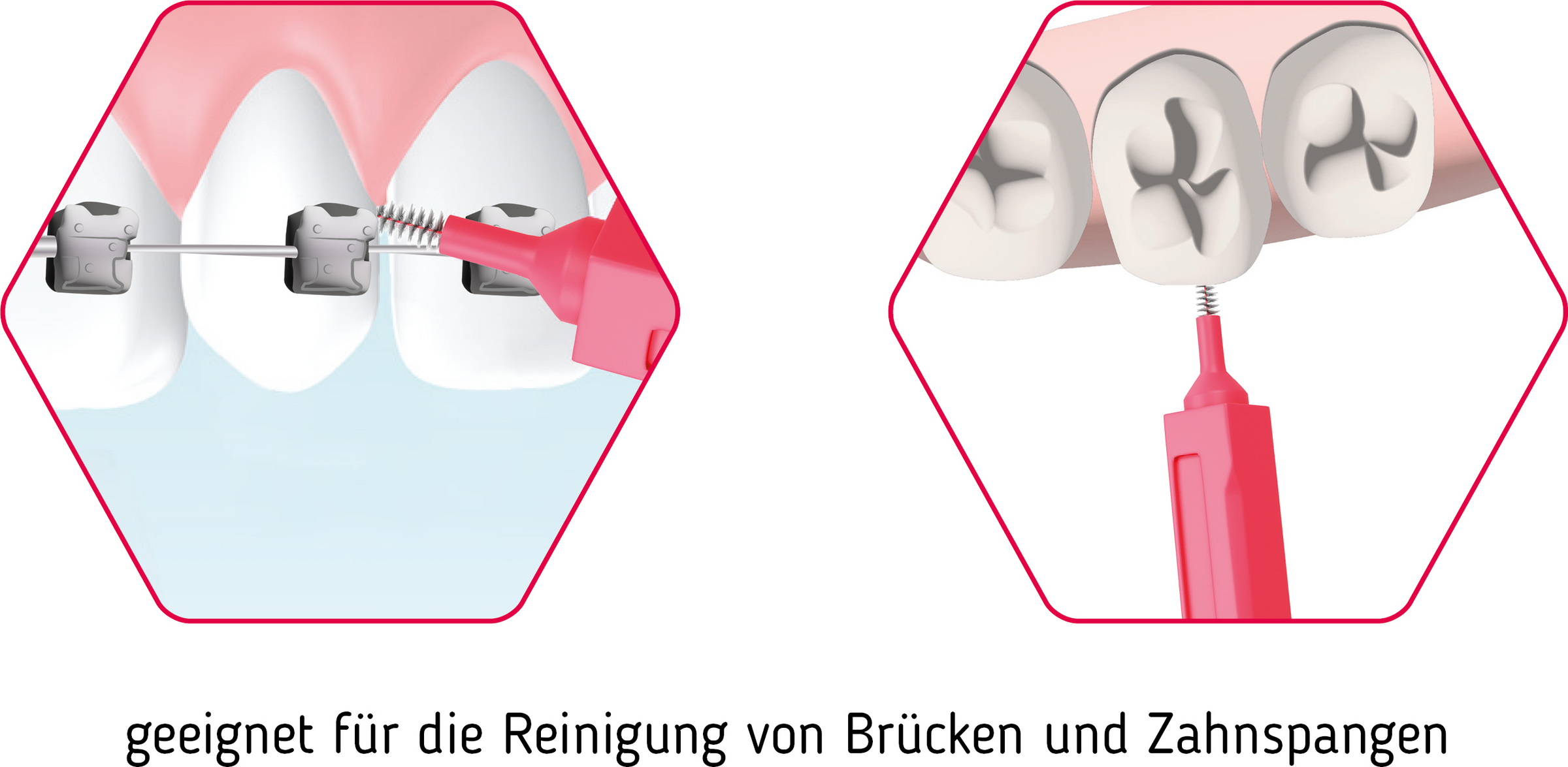 فرشاة ما بين الأسنان بريميوم ISO 3 متوسطة 5