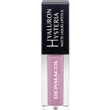 Hyaluron Hysteria Matte Liquid Lipstick No. 01