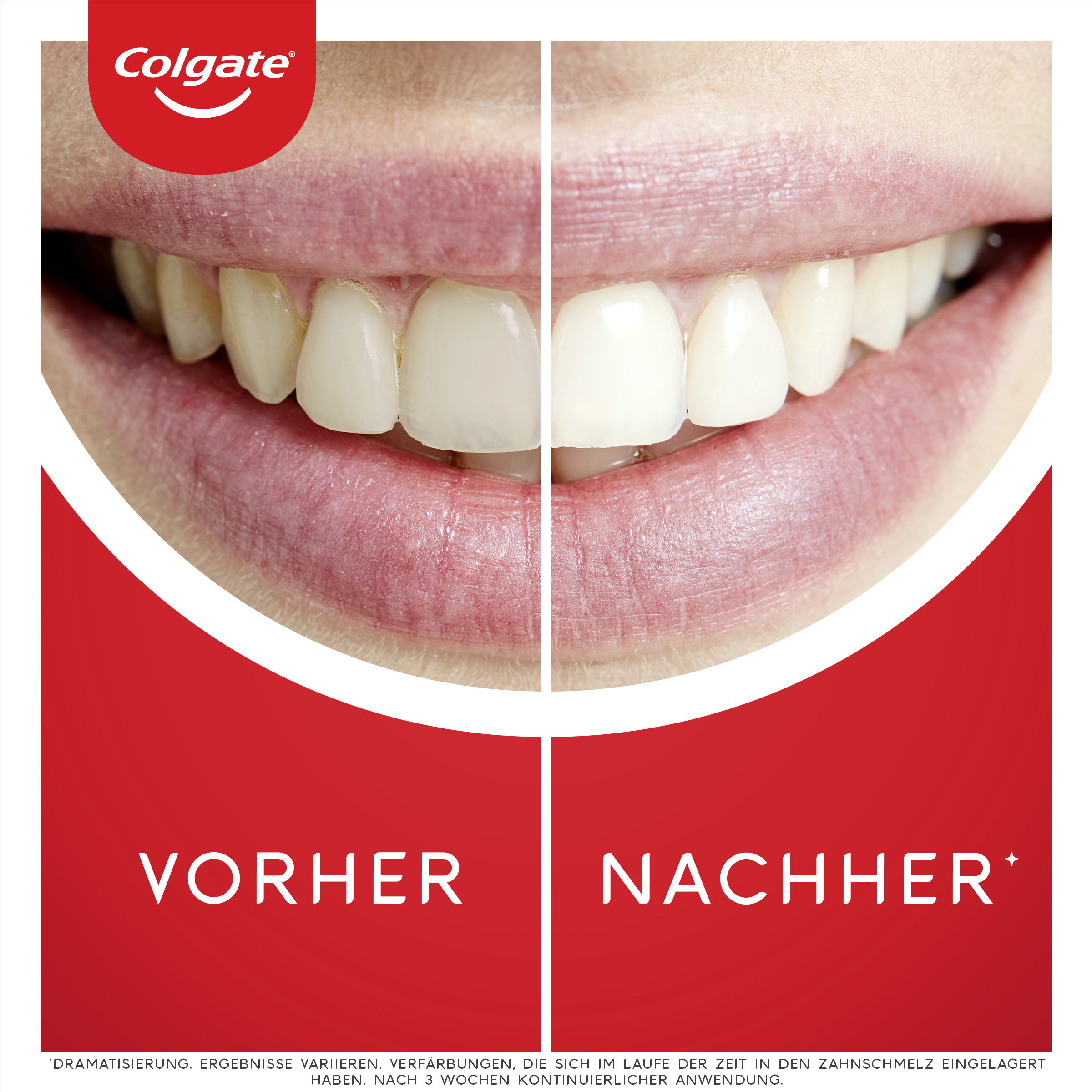 معجون أسنان Max White Ultra Freshness Perls 5