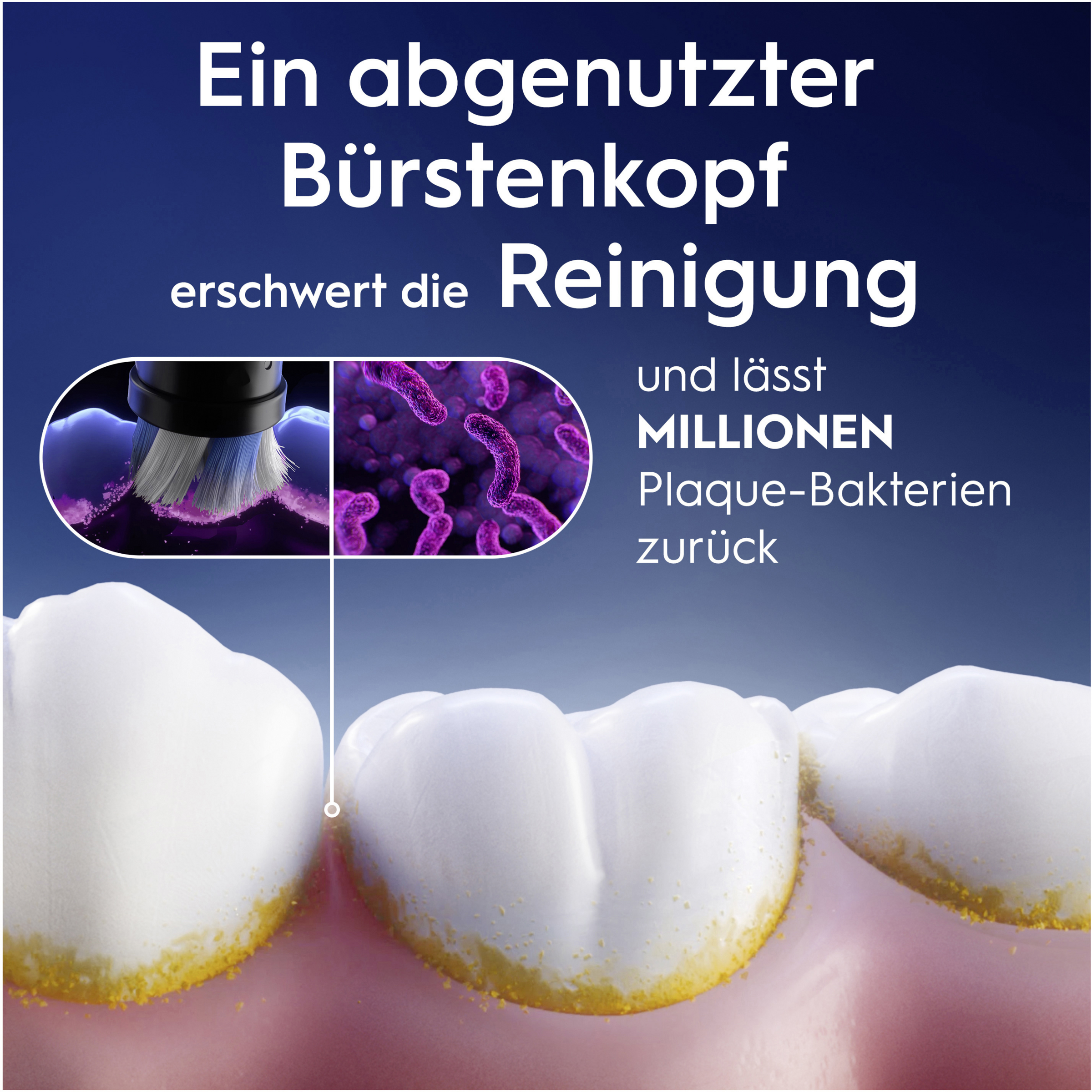 رؤوس فرشاة iO لتنظيف لطيف 10