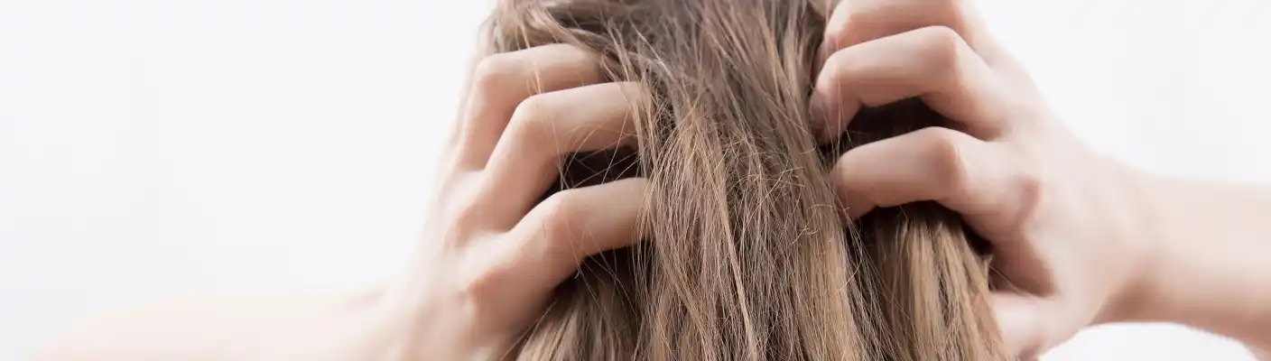 Hausmittel gegen juckende Kopfhaut: Tipps vom Experten Hausmittel gegen juckende Kopfhaut: Tipps vom Experten