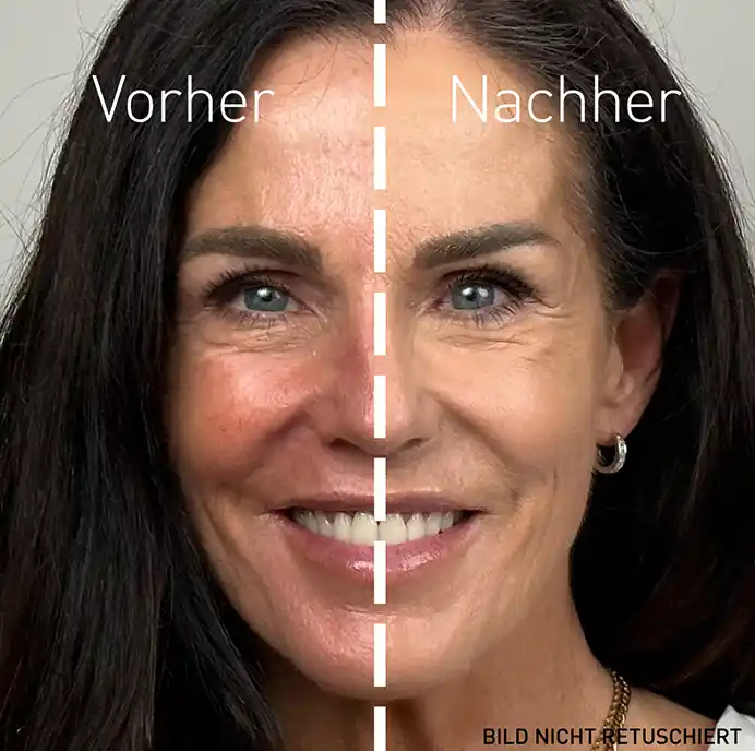 Vorher/Nachher